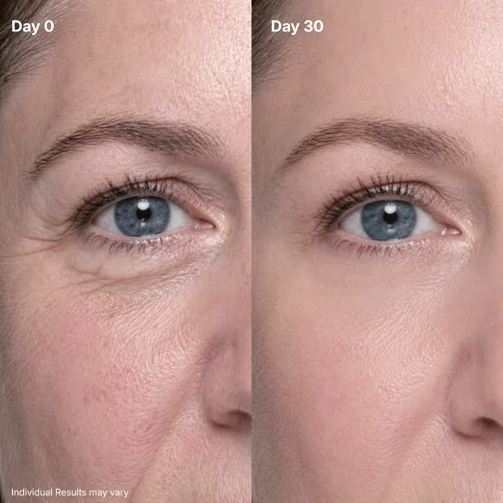 AQA🔥P7 Eye Renewal Cream